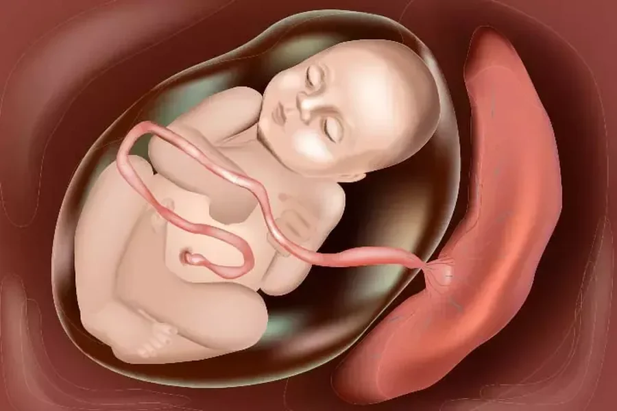 Anterior Placenta